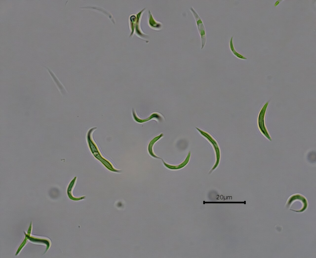 Mikroalg, antibiyotik kalıntılarını atık sudan uzaklaştırarak çevresel kontaminasyonu azaltır
