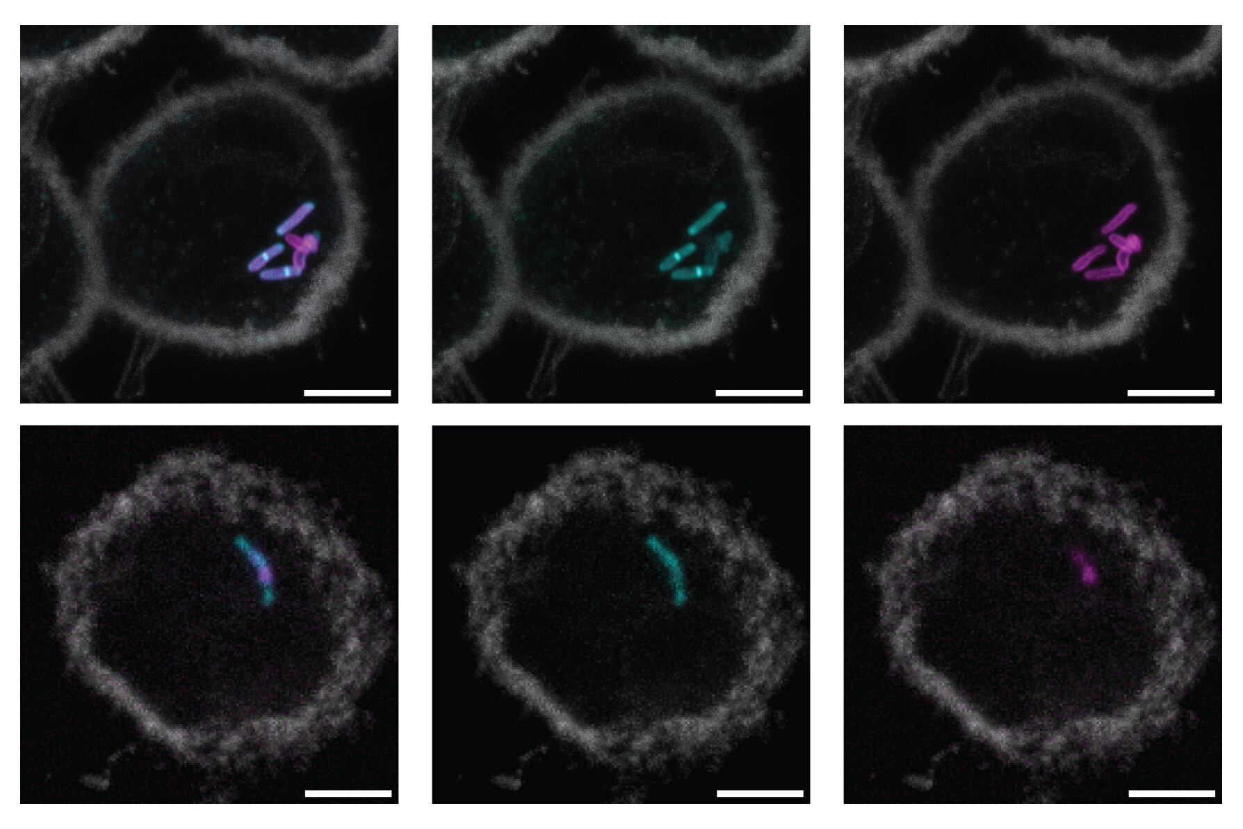 Yeni moleküler etiket daha basit, daha hızlı tüberküloz testlerine yol açabilir