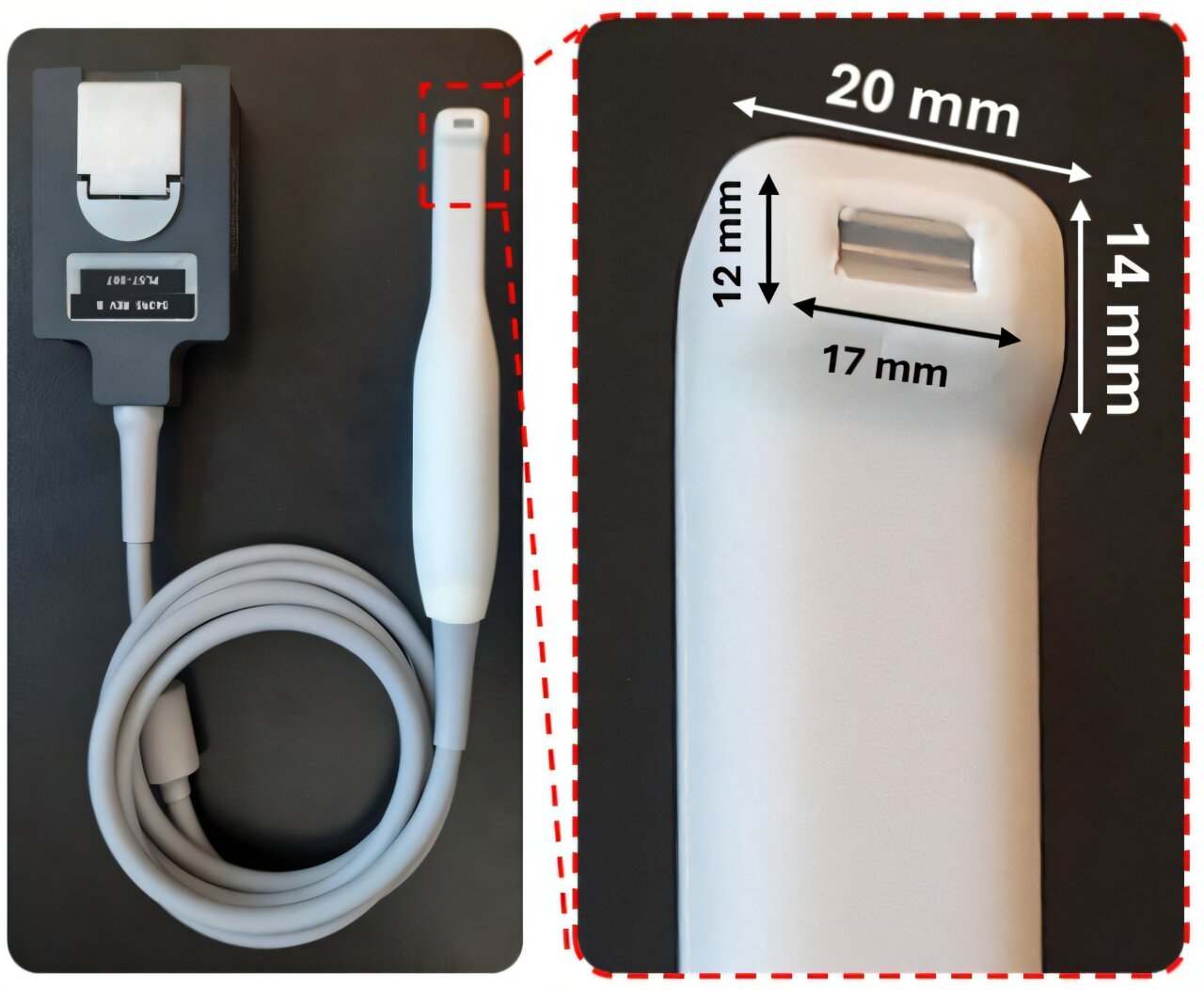 Ultrason diş fırçası gizli sakız problemleri için ağrısız kontroller vaat ediyor