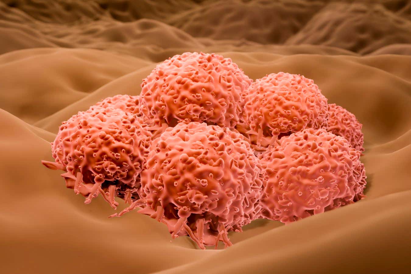 Herpes virüsü yakında şiddetli cilt kanserini tedavi etmek için onaylanabilir