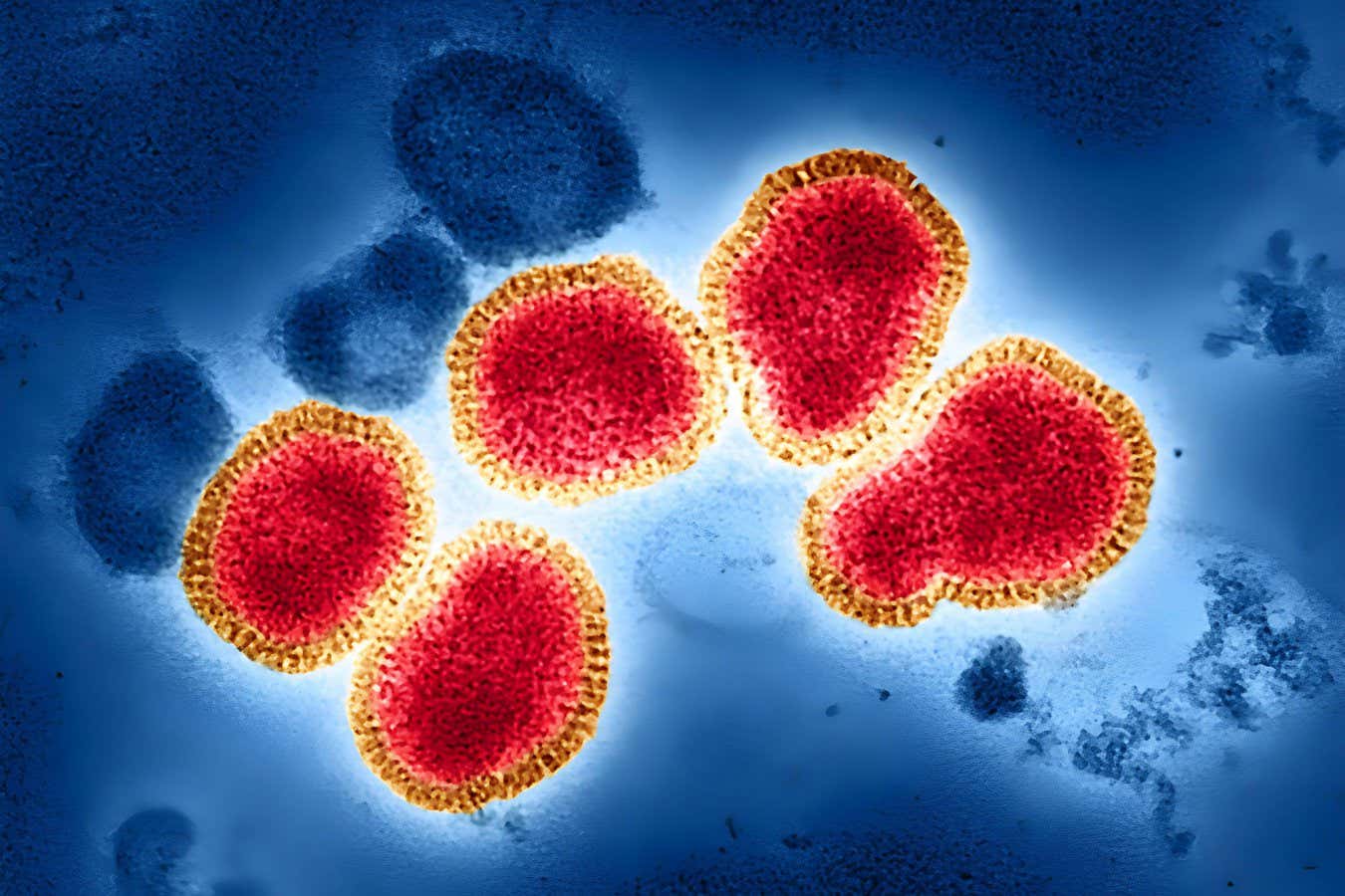 Tek antiviral atış, grip aşılarından daha iyi koruma sağlayabilir