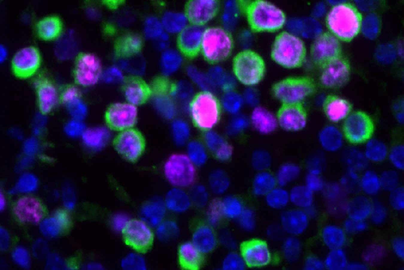 Lung tissue samples from mice, showing the nuceli of cells (blue), cancerous cells (green) and markers of proliferation (magenta)