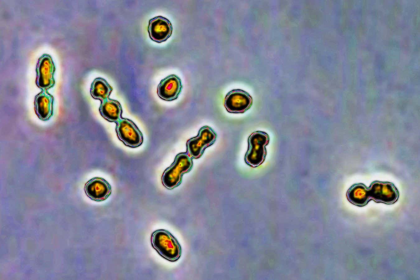 İnsan sütü, hamilelikleri tehlikeye atan enfeksiyonlarla savaşmaya yardımcı olabilir