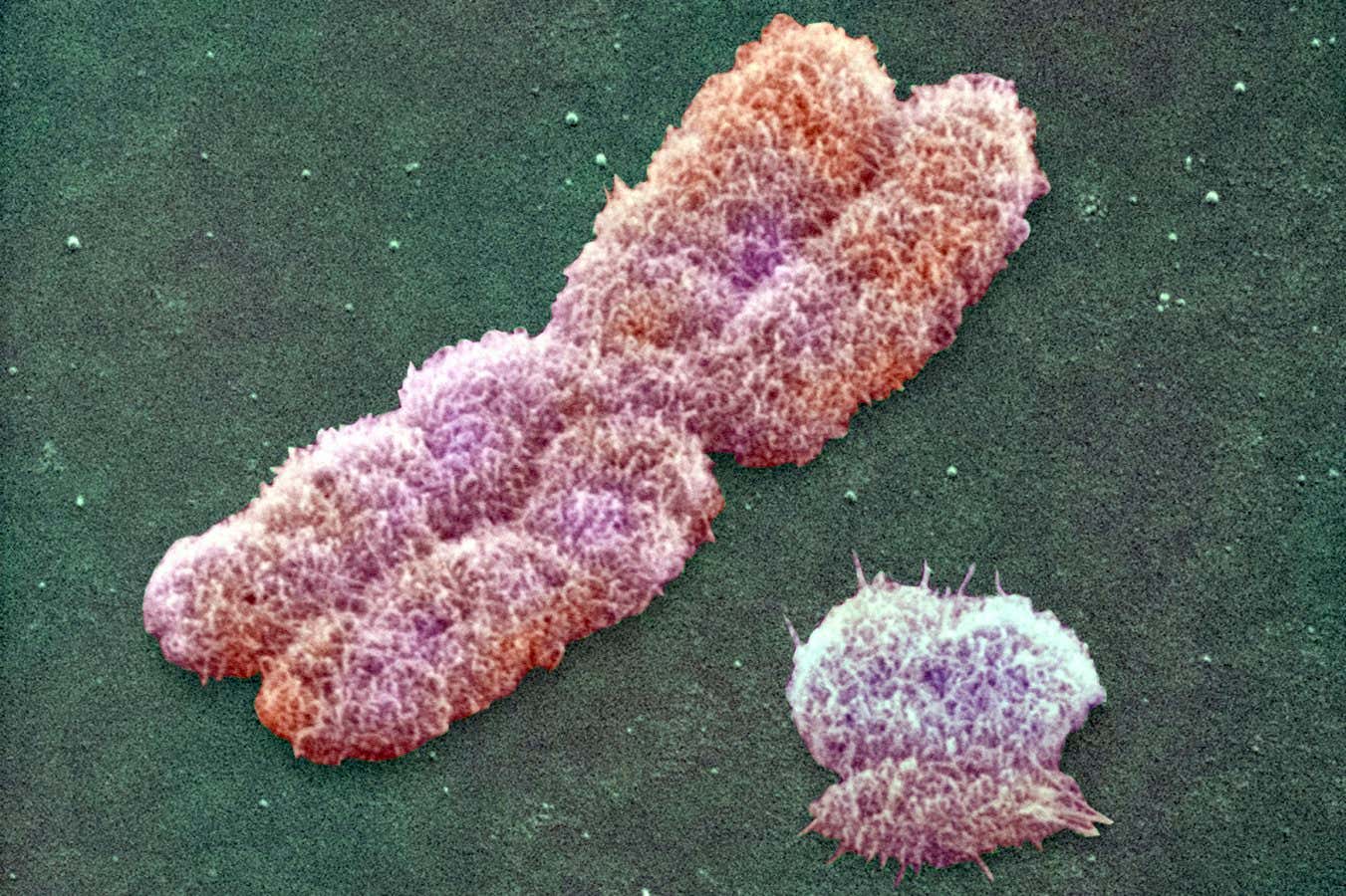 A human Y (right) and X chromosome seen with a scanning electron microscope