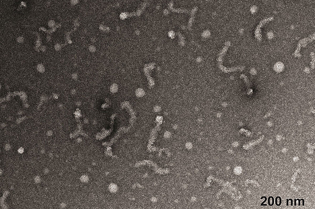 Kimyacılar, amyotrofik lateral sklerozla bağlantılı protein hakkında yeni bilgiler ortaya koyuyor