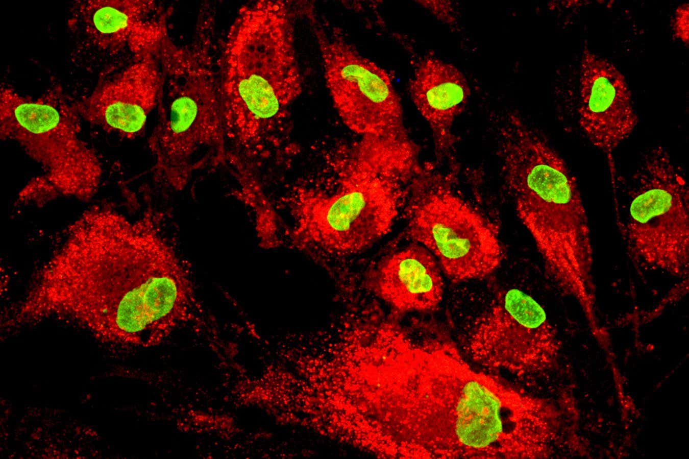 Kök hücre tedavisi kalp krizinden sonra kalp yetmezliği riskini azaltır