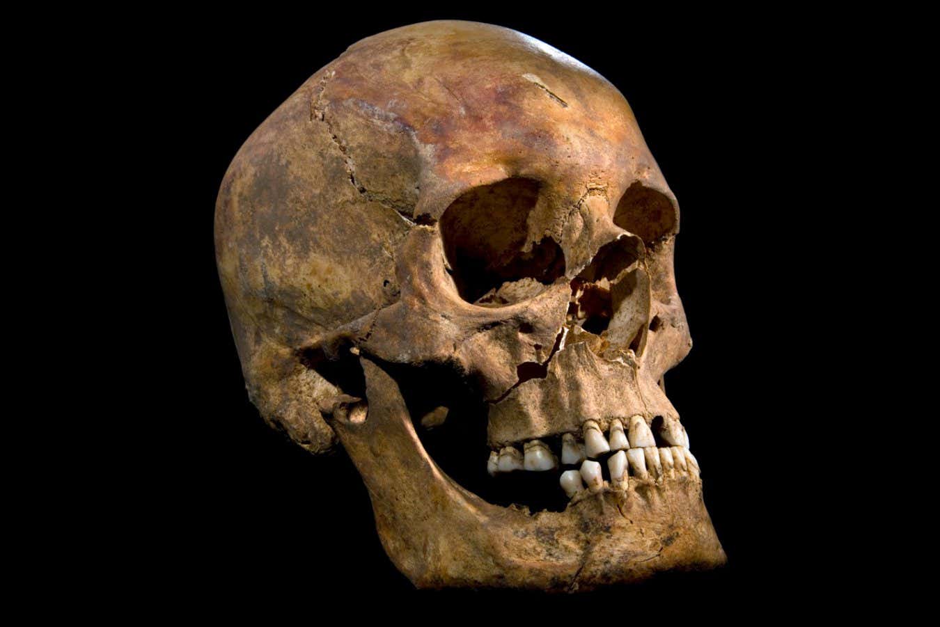 The skull of King Richard III