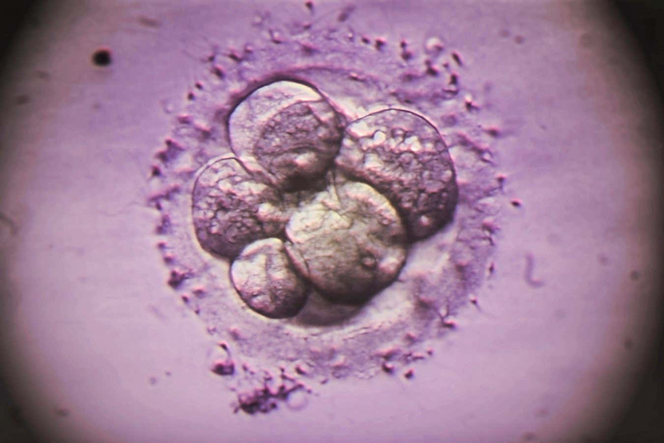 Yaygın IVF testi embriyolardaki bazı genetik anormallikleri gözden kaçırıyor