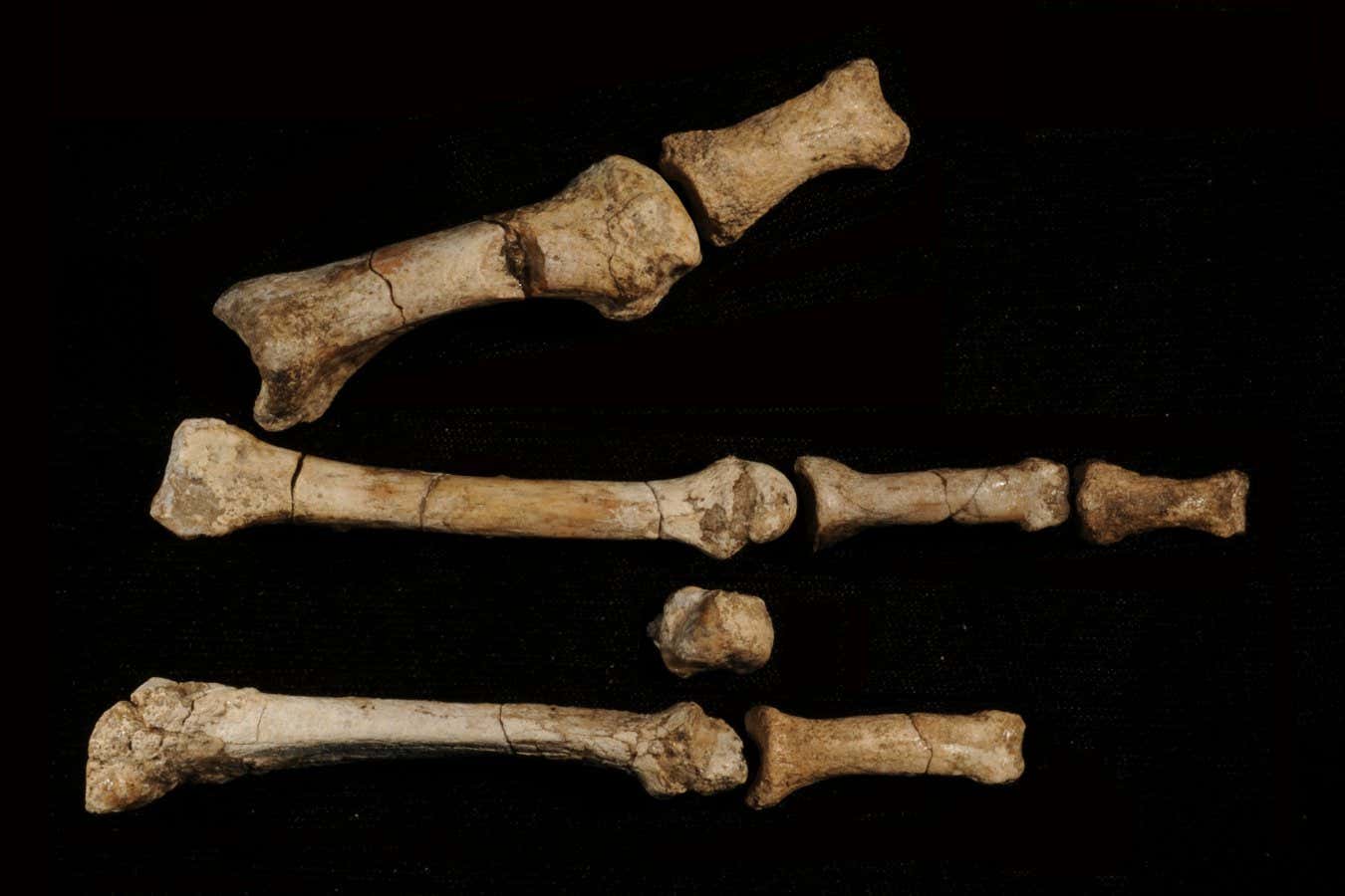 The bones arranged in the approximate anatomical position of the right foot