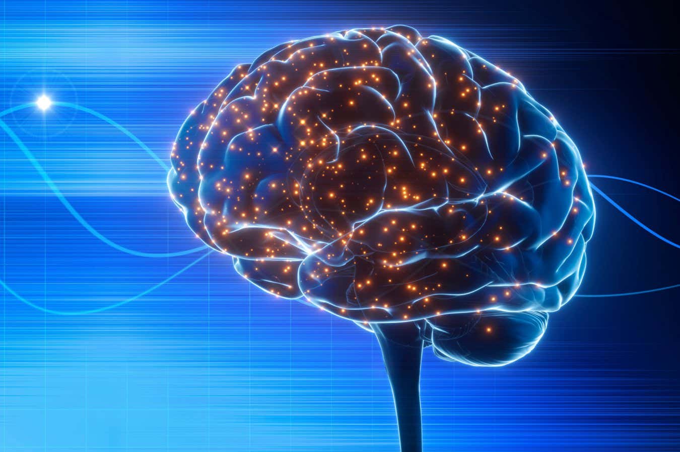 Ultrason, beyin enkazını temizleyerek felç sonrası hayatta kalmayı artırabilir