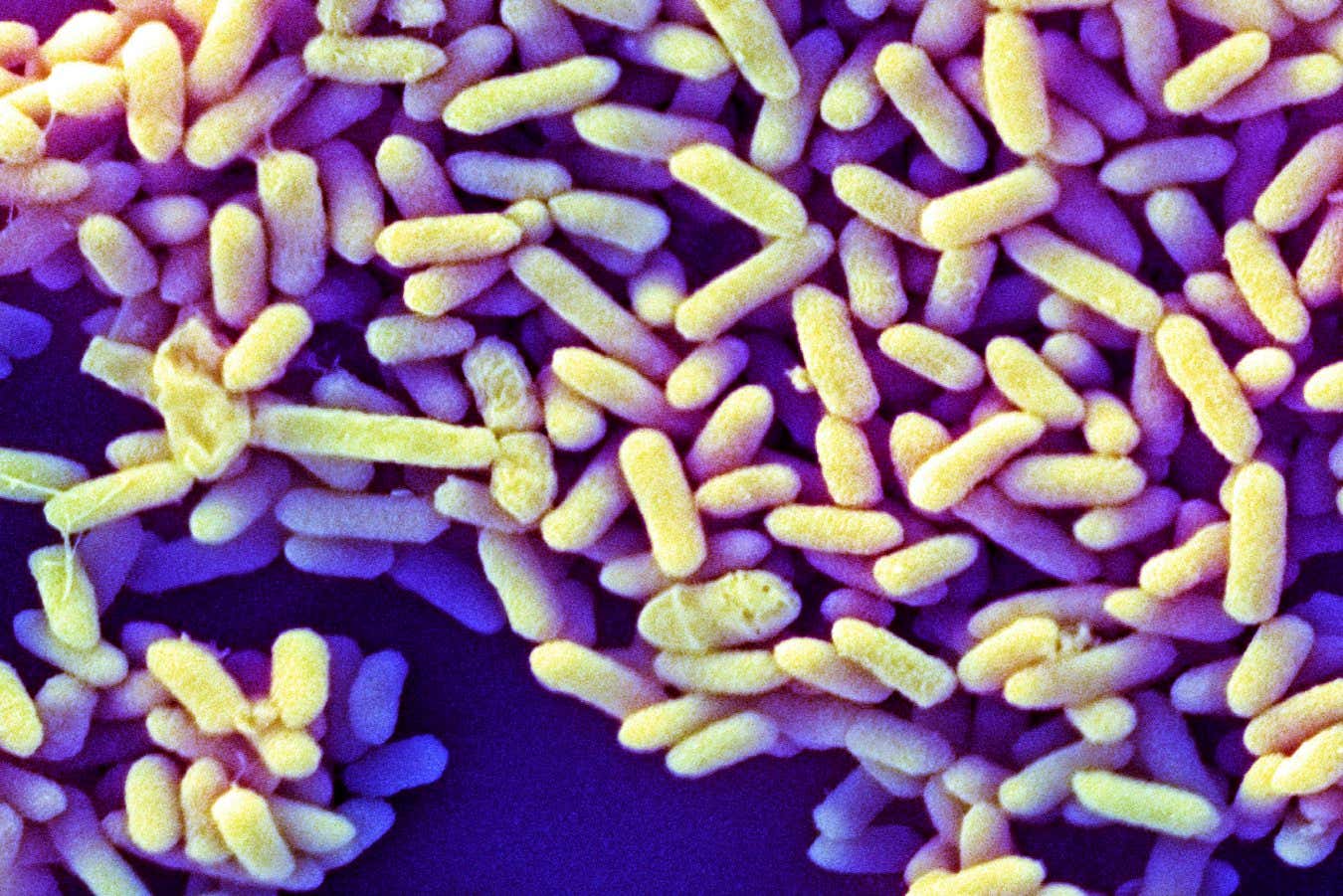 Batı'daki bebek mikrobiyomları diğer yerlerdekilerden nasıl farklı?